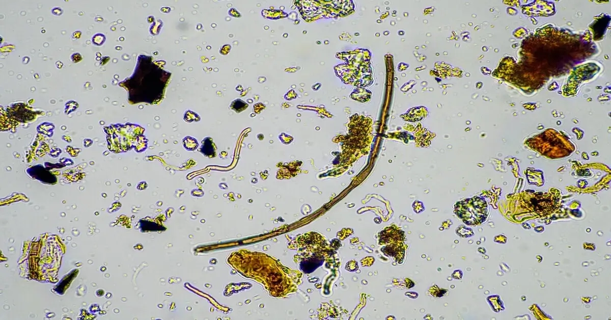 Lots of different microbes growing in the soil under a microscope.
