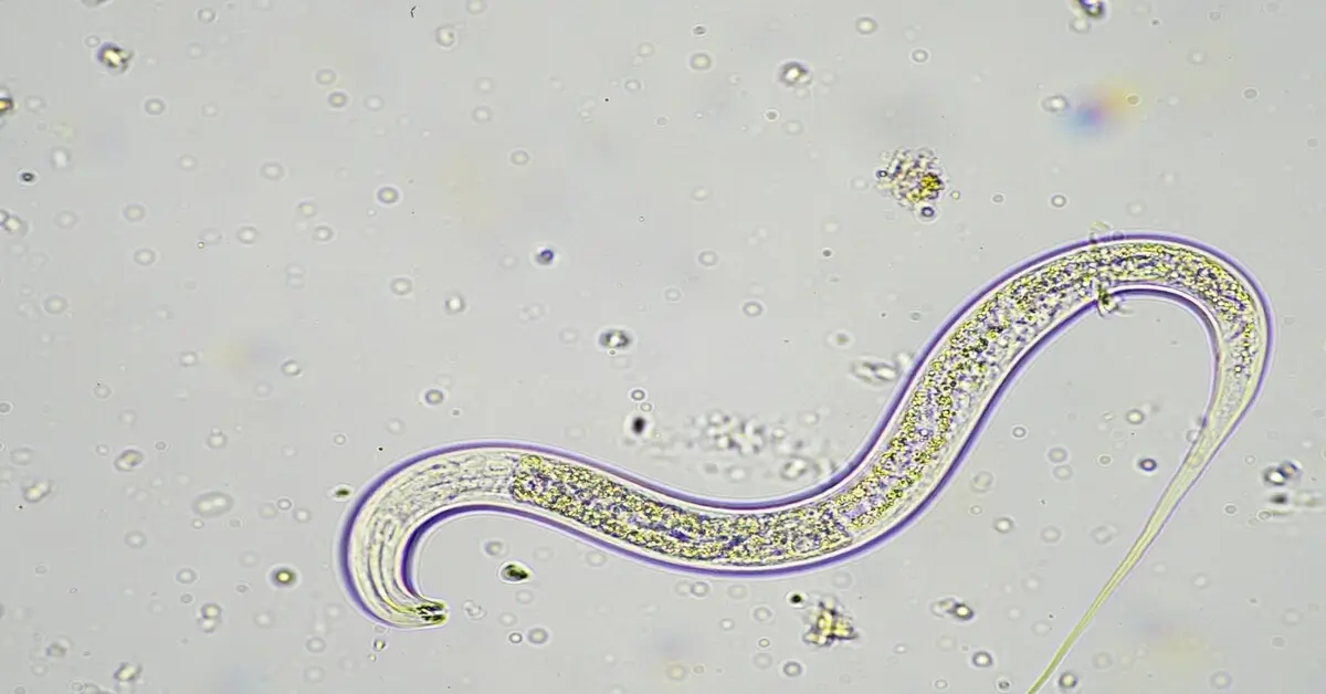 Microscopic view of a nematode that lives in the soil.